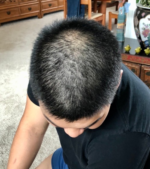 944B818E-35E9-4DB3-81C2-BB72F10942C8